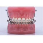 Typodont Forsus 3M Unitek