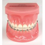 Typodont Clarity SL 3M Unitek