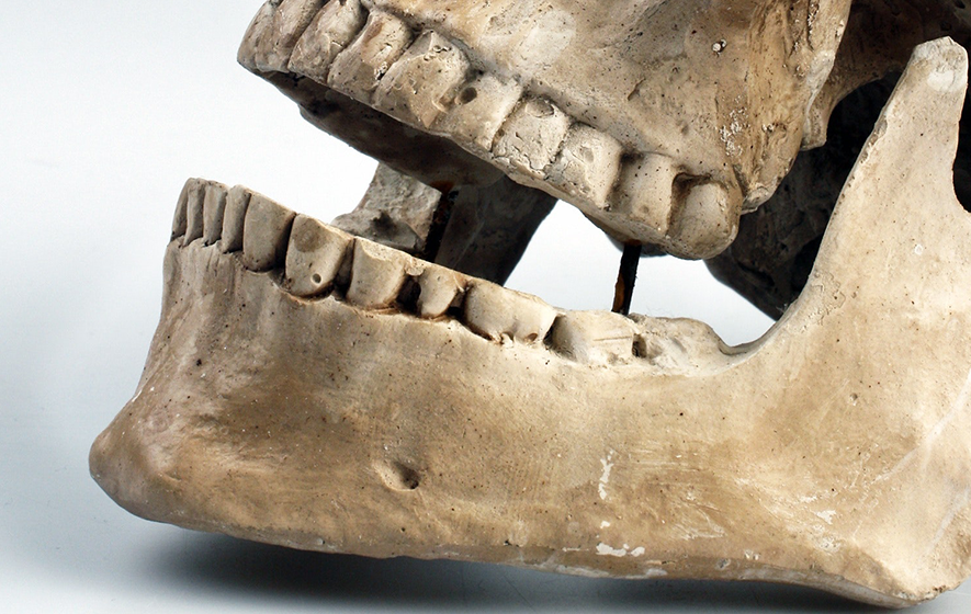 Mandibula